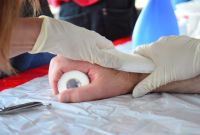 Praxistraining zum casten eines Unterarms